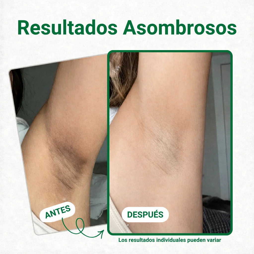 Comparación visual de la apariencia de las axilas